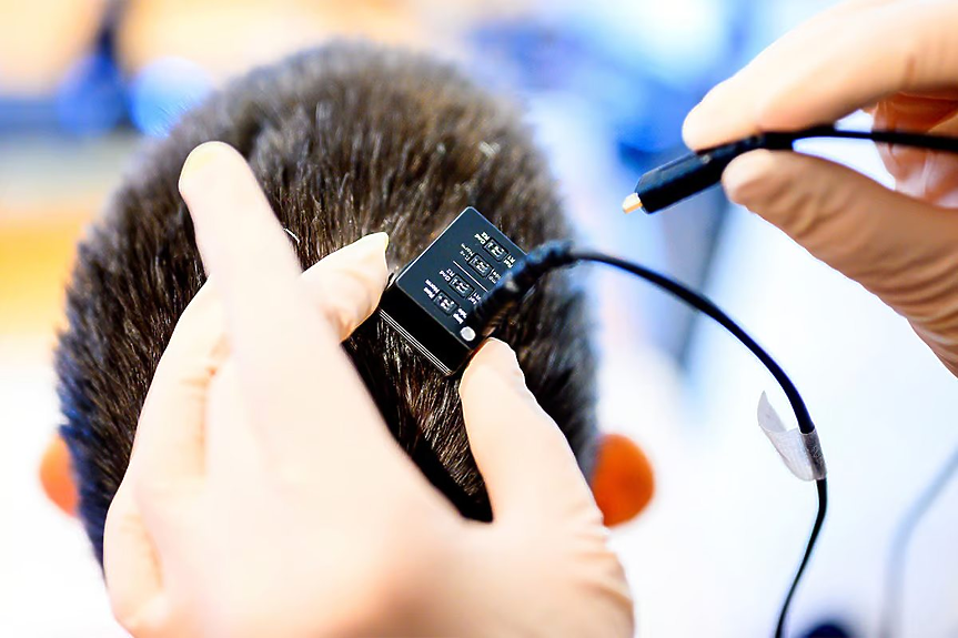 AI възстановява гласа на парализирани хора в реално време