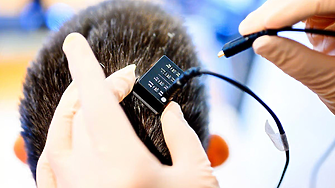 AI възстановява гласа на парализирани хора в реално време